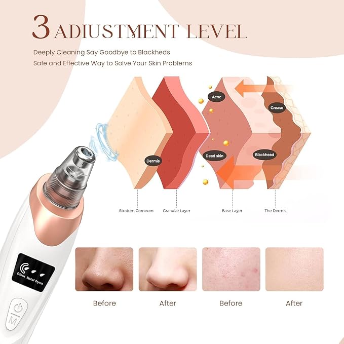 Rechargeable 4-in-1 Electric Facial Pore Cleanser